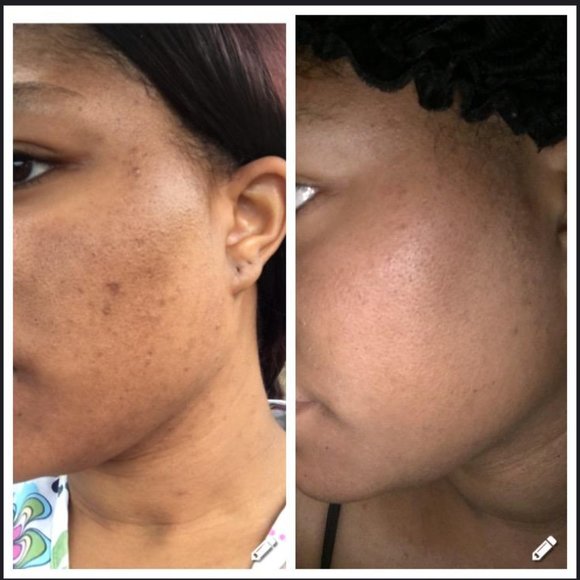 Bio Oil - Picture 9 of 10